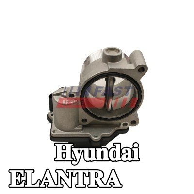 FAST جسم الخانق مع حشية/مانع تسرب, يجب تدريب/تحديث وحدة التحكم/البرنامج, مع جهاز استشعار — 2008 Hyundai Elantra