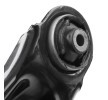 RIDEX Kontrol kolu tamir kiti Ön Aks — Opel Combo (5)