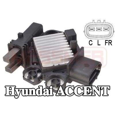 ERA منظم جهد المولد — Hyundai Accent