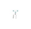 BOSCH Fren pabucu montaj kiti — Land Rover Defender (4)